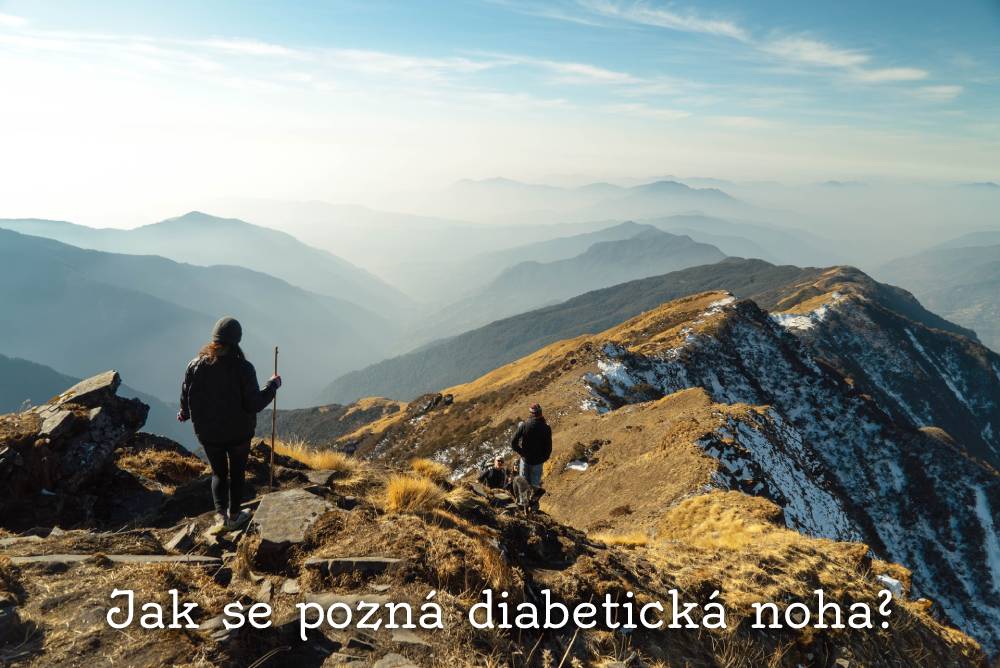 Diabetická noha: Jak ji poznat a léčit?